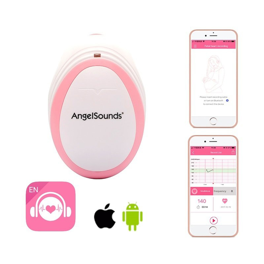 Angelsound magzati szívhangfigyelő okostelefonhoz